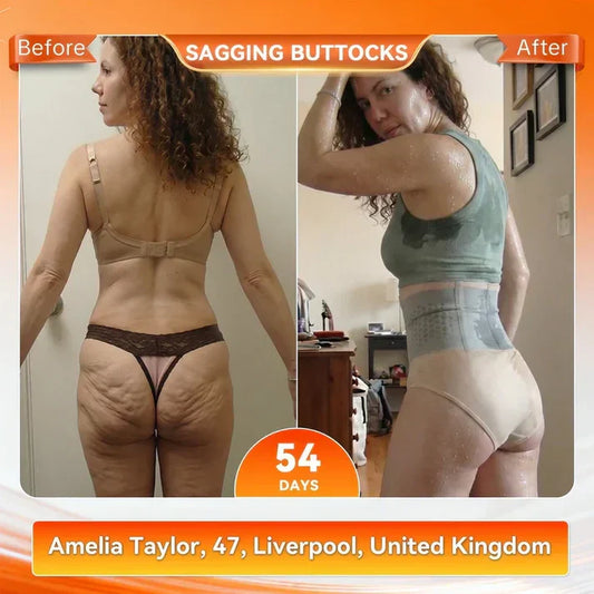 4-In-1 Micro-Particle Sculpting & Fat-Burn Shorts (Buy 1 Get 1 FREE)